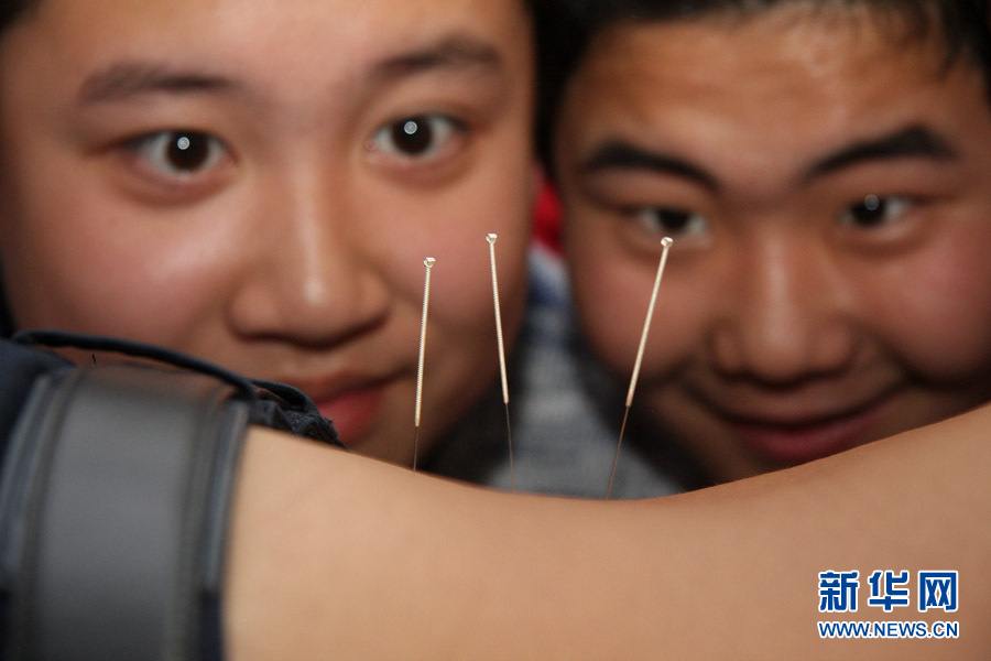 Иглоукалывание китайской медицины распространяется по миру