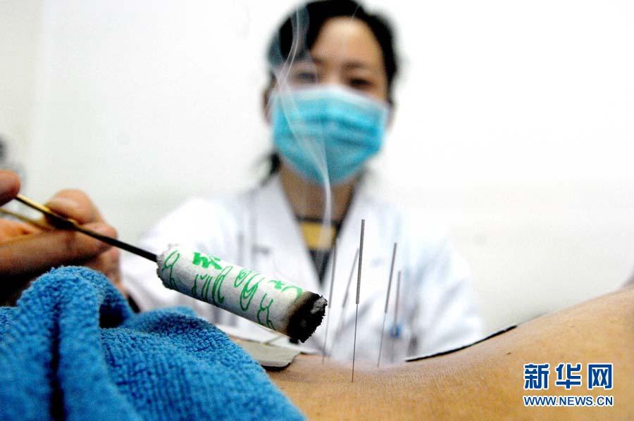 Иглоукалывание китайской медицины распространяется по миру