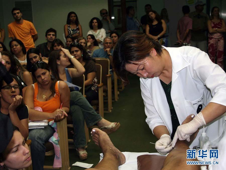 Иглоукалывание китайской медицины распространяется по миру